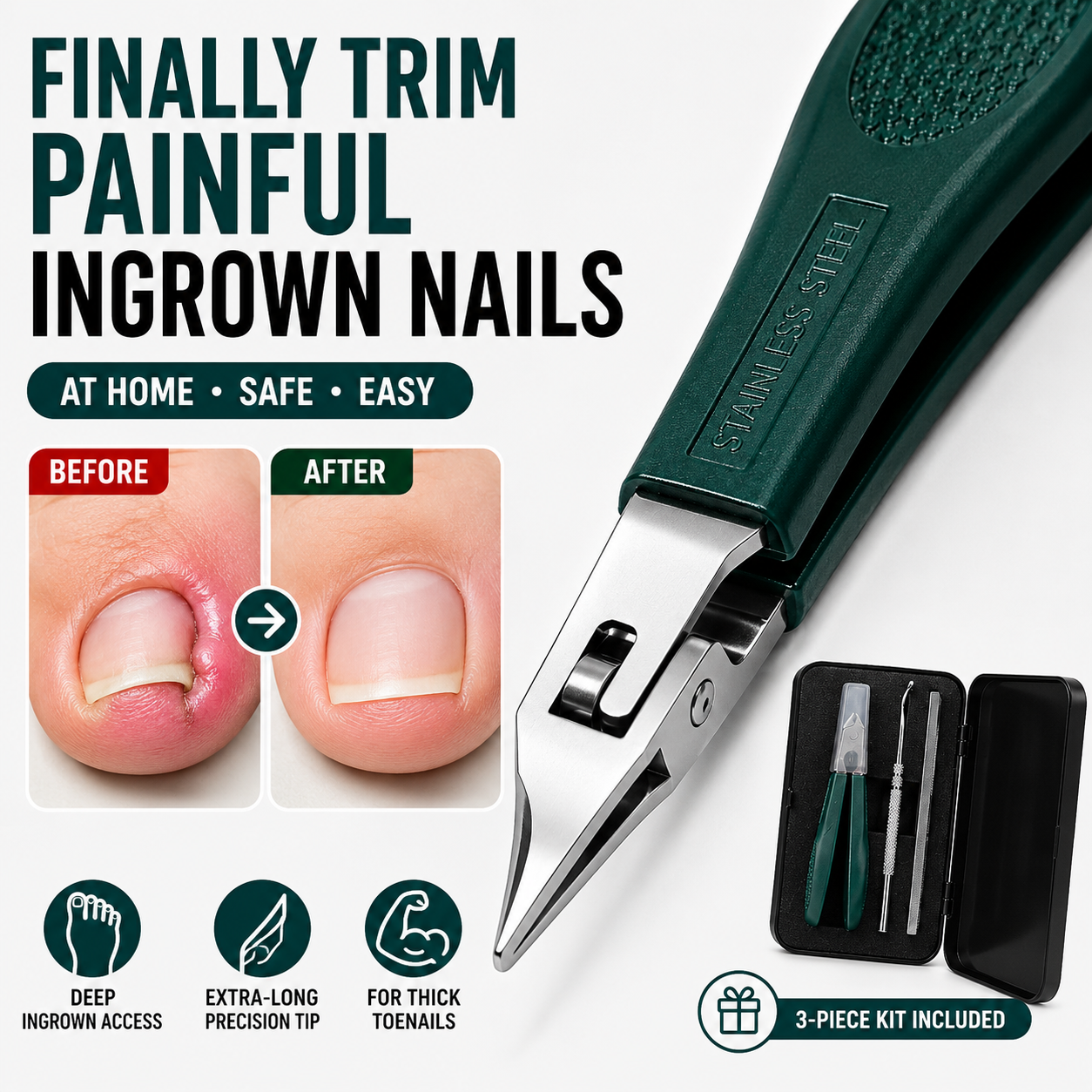 Eagle Beak Beveled Nail Clippers | Premium 3-Piece Grooming Kit ✂️🛡️ - image 2