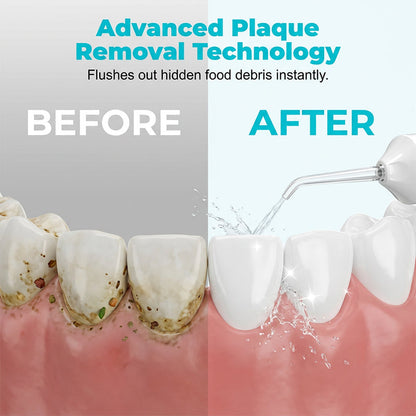 Portable Cordless Water Flosser for Teeth - image 3